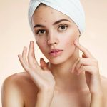 acne and pimples treatment